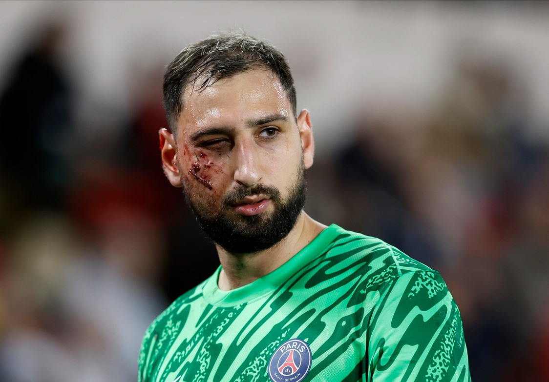 摩纳哥坚守主场优势，法甲夺冠希望加速实现的简单介绍